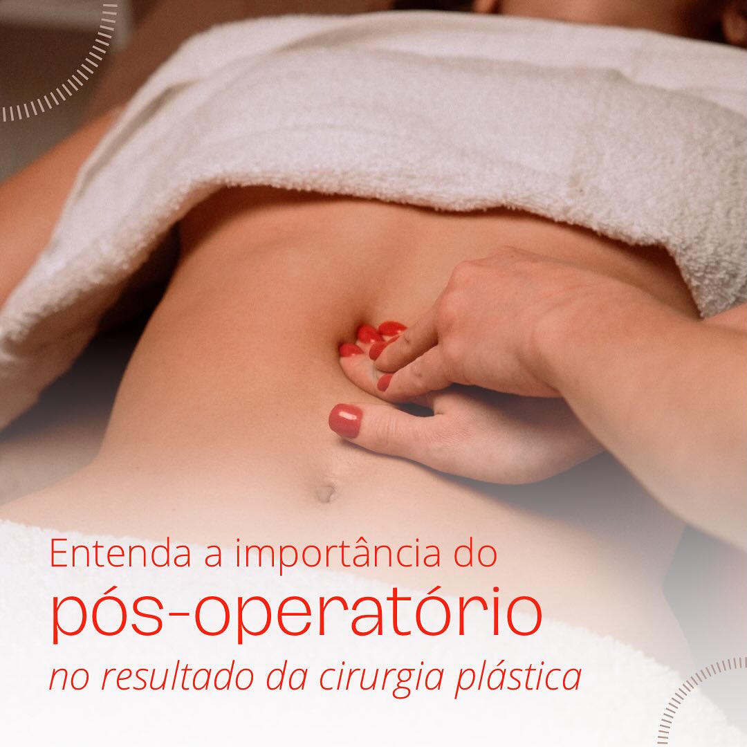 Transforme o seu corpo com a radiofrequência corporal